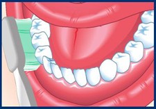 drawn-open-mouth-with-toothbrush-at-45-degree-angle-between-gums-and-teeth