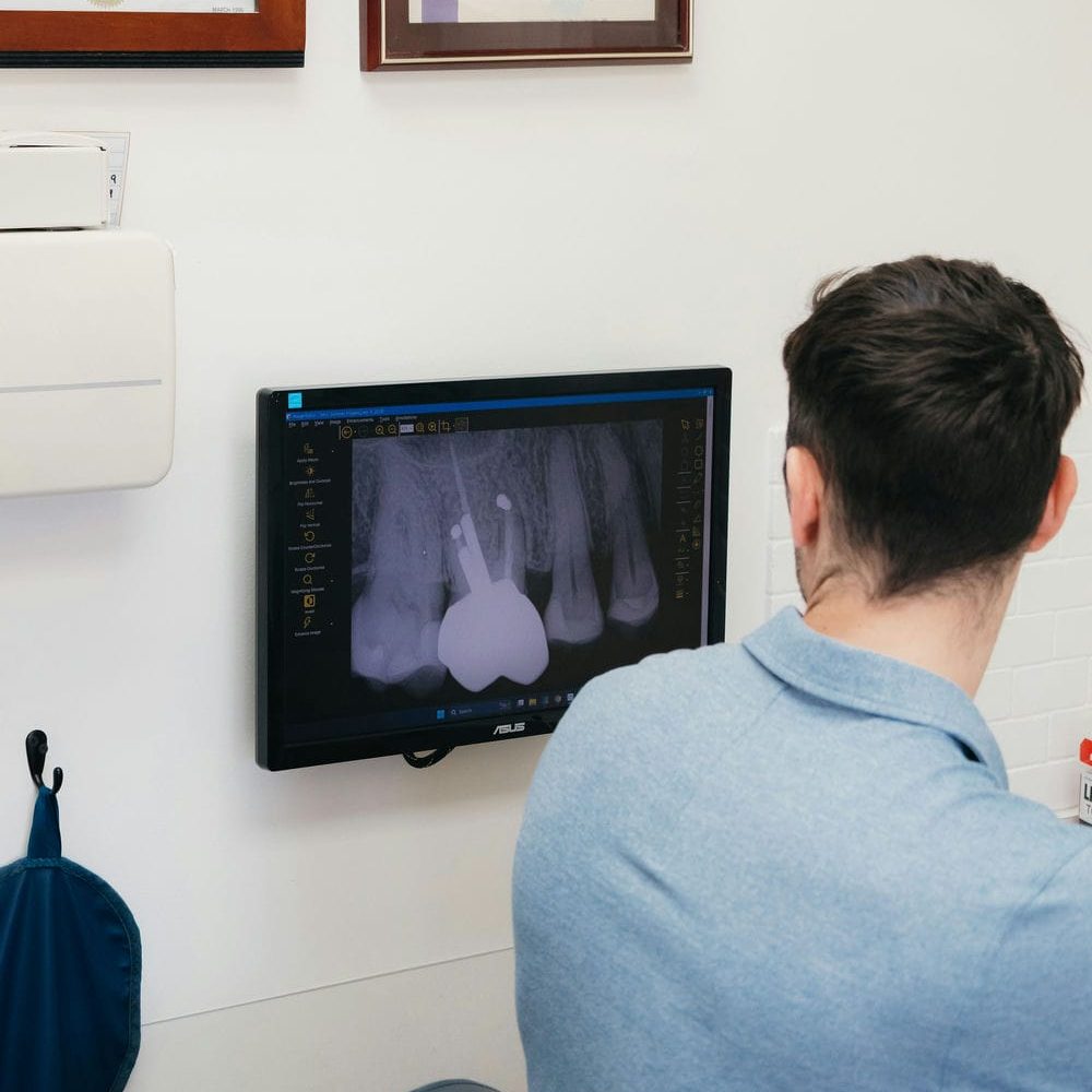 Dentist reviewing an X-ray on screen to decide whether a damaged tooth needs to come out