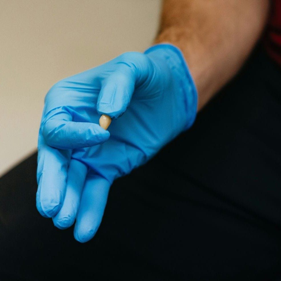Dentist holding a single porcelain crown, one of the material choices for a dental crown